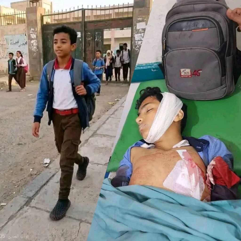 المخلافي: استشهاد طفل برصاص قناص في تعز جريمة مكتملة الأركان ومطالبات بمحاسبة الجناة